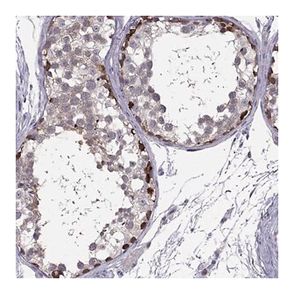 Merck Anti-RSPH14 antibody produced in rabbit