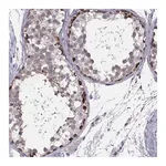 Merck Anti-RSPH14 antibody produced in rabbit