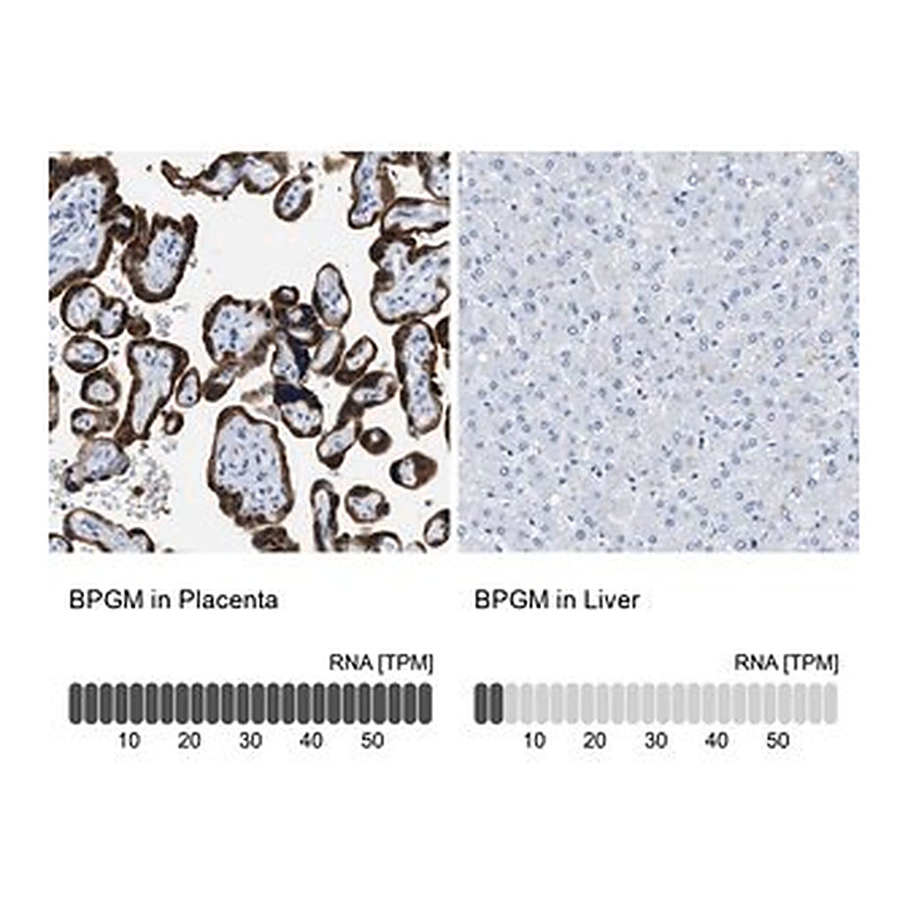 Merck Anti-BPGM antibody produced in rabbit