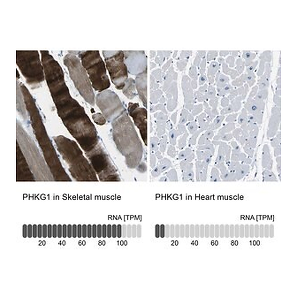 Merck Anti-PHKG1 antibody produced in rabbit