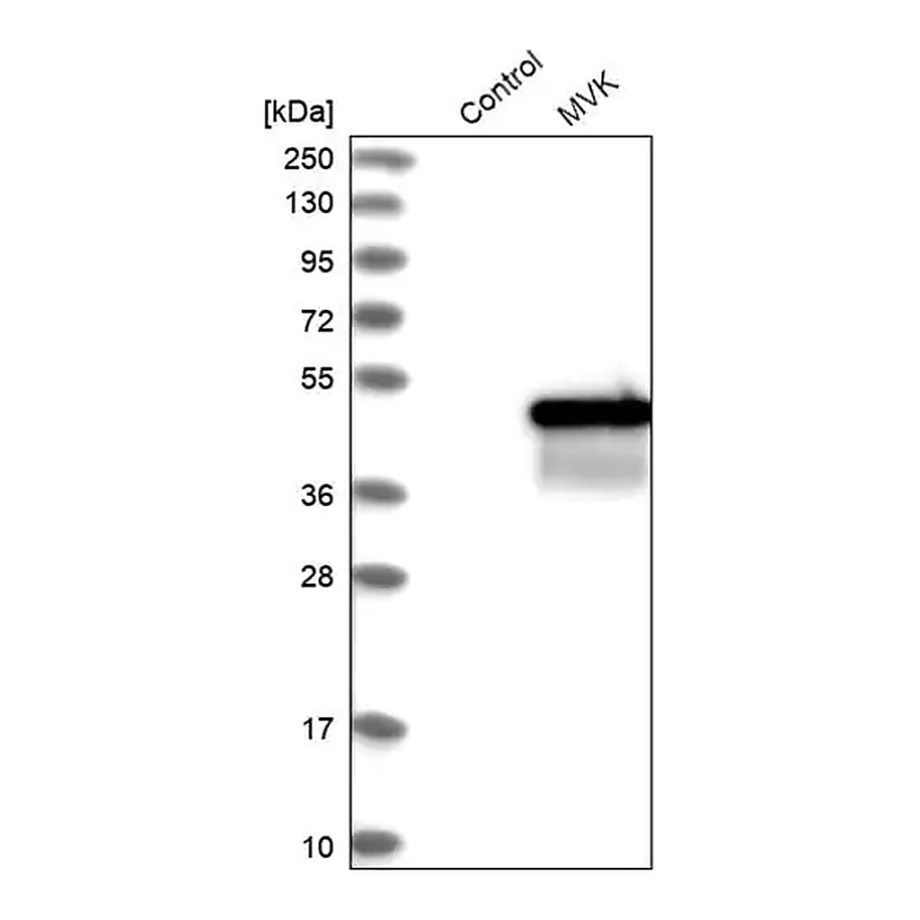 Merck Anti-MVK antibody produced in rabbit