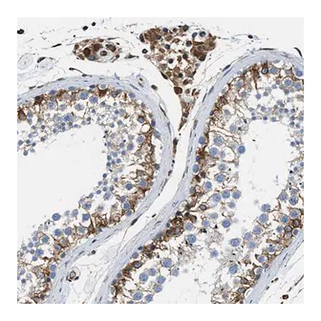 Merck Anti-HSD17B12 antibody produced in rabbit