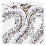 Merck Anti-HSD17B12 antibody produced in rabbit