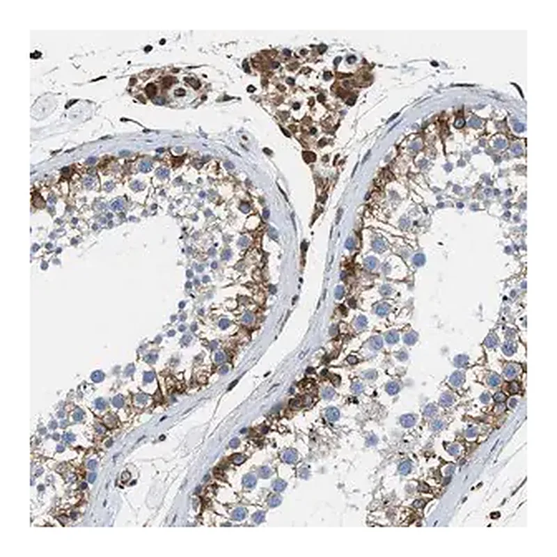 Merck Anti-HSD17B12 antibody produced in rabbit