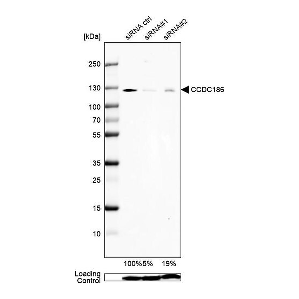 Merck Anti-CCDC186 antibody produced in rabbit