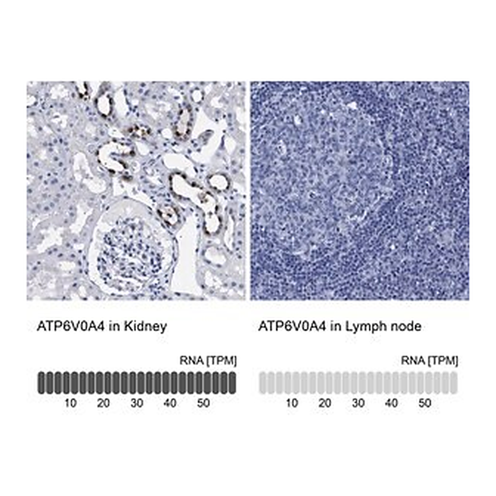 Merck Anti-ATP6V0A4 antibody produced in rabbit