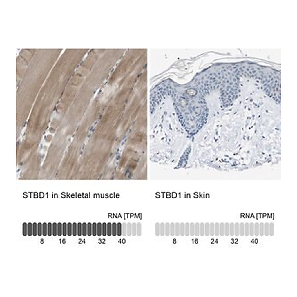Merck Anti-STBD1 antibody produced in rabbit