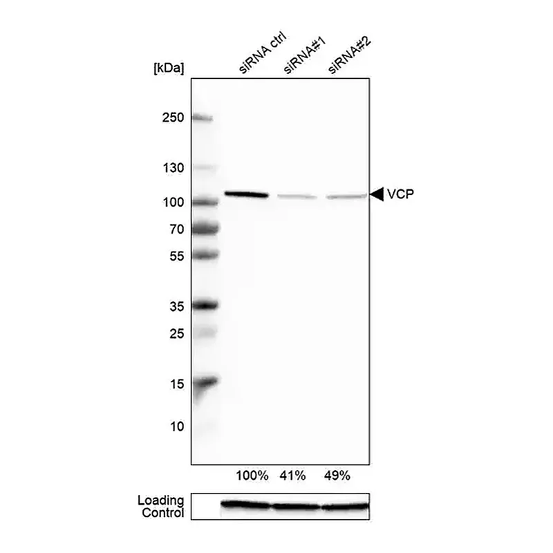 Merck Anti-VCP antibody produced in rabbit
