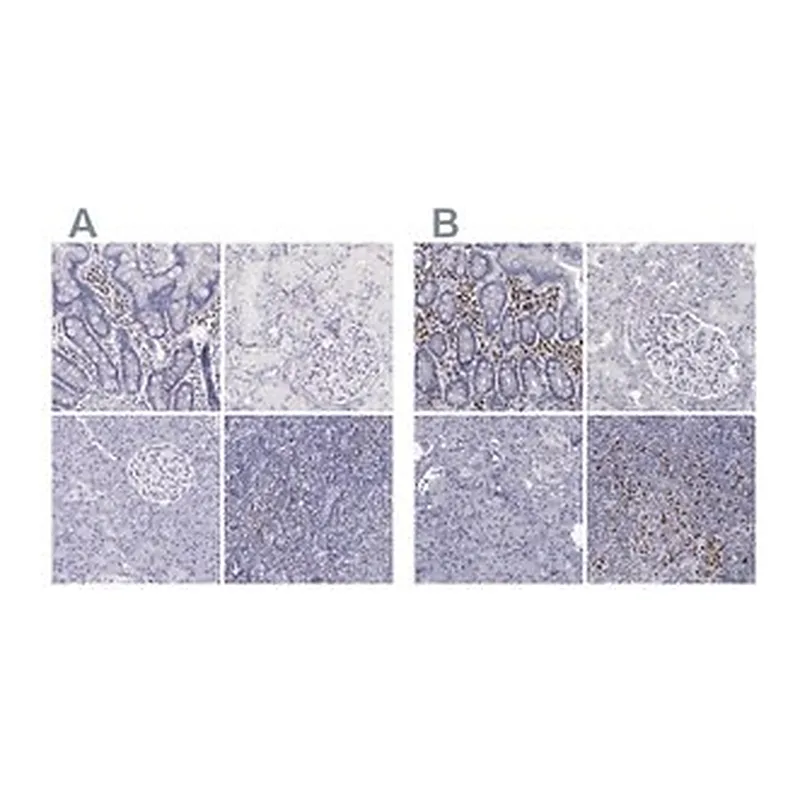 Merck Anti-IRF4 antibody produced in rabbit