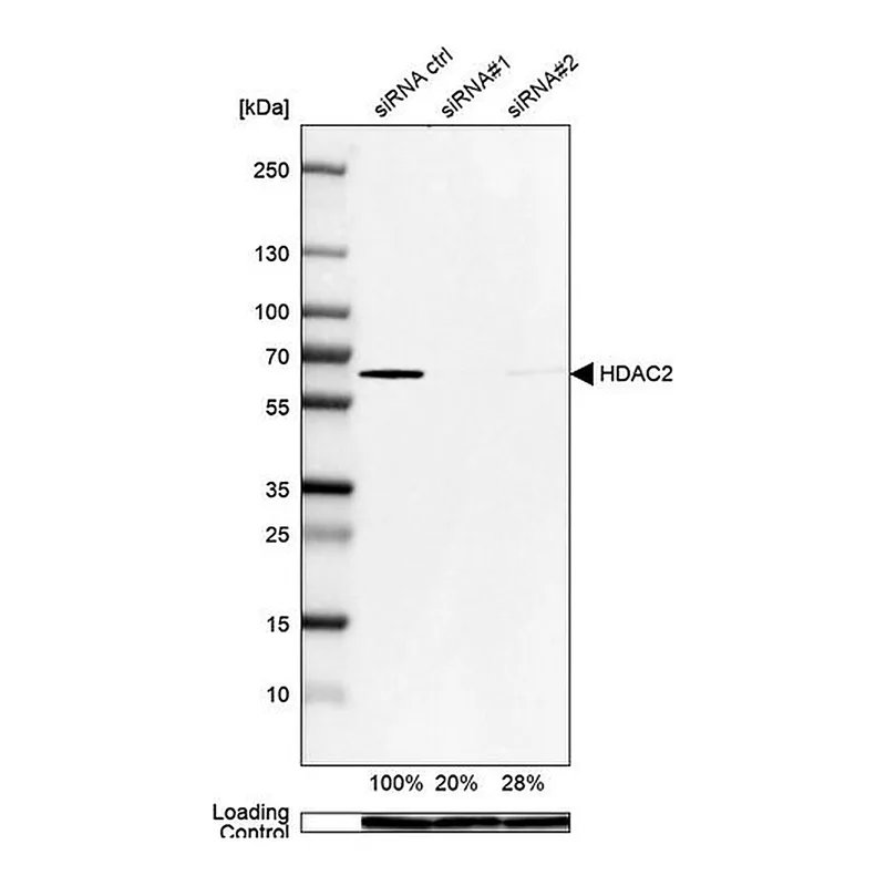 Merck Anti-HDAC2 antibody produced in rabbit