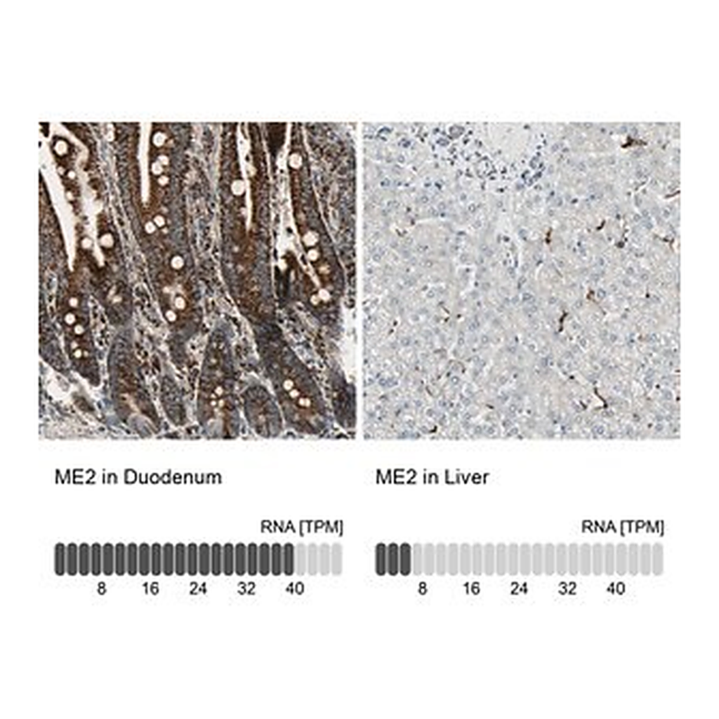 Merck Anti-ME2 antibody produced in rabbit