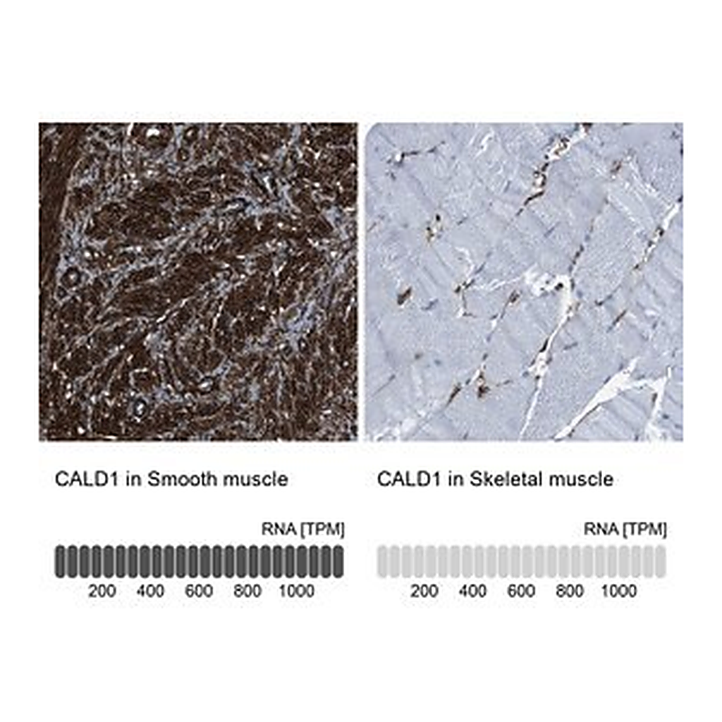 Merck Anti-CALD1 antibody produced in rabbit
