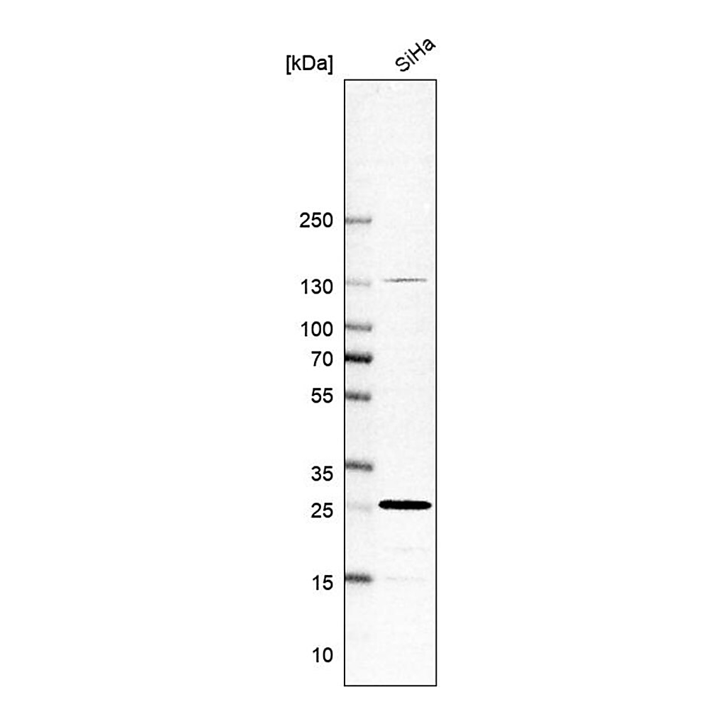 Merck Anti-RAB21 antibody produced in rabbit