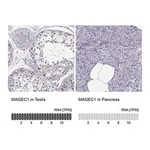 Merck Anti-MAGEC1 antibody produced in rabbit