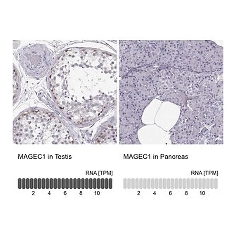 Merck Anti-MAGEC1 antibody produced in rabbit