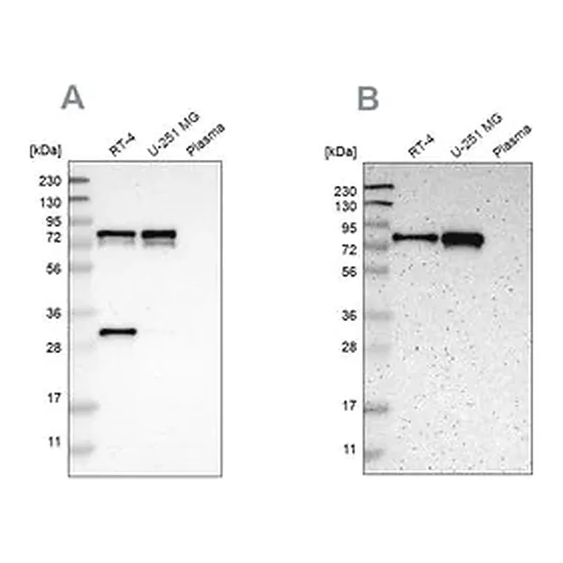 Merck Anti-MTDH antibody produced in rabbit