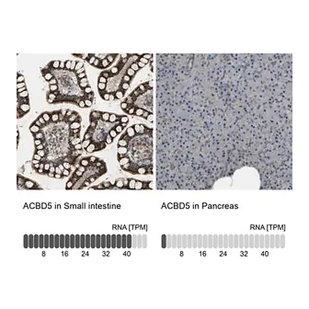 Merck Anti-ACBD5 antibody produced in rabbit