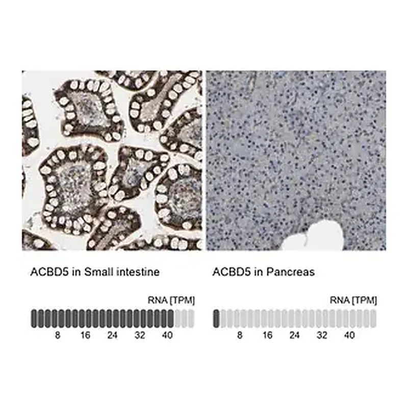 Merck Anti-ACBD5 antibody produced in rabbit