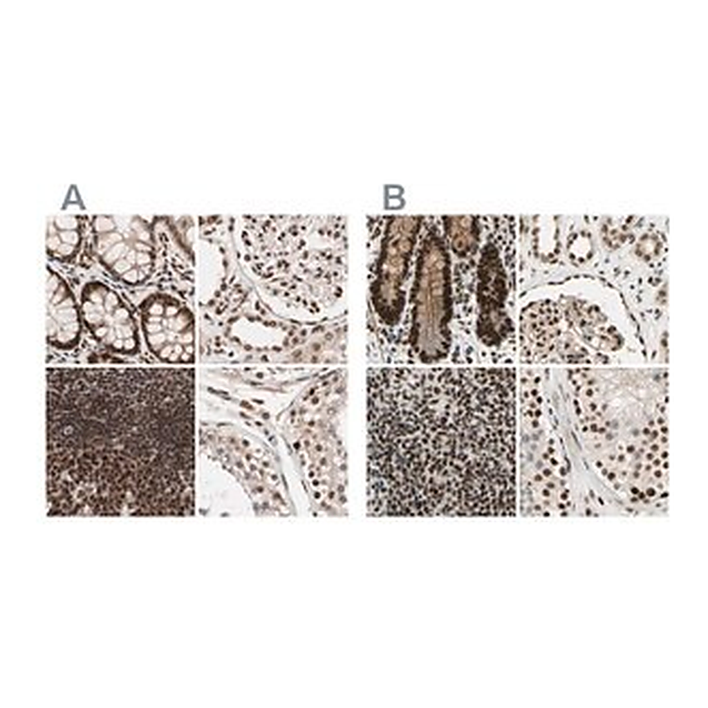 Merck Anti-CHAMP1 antibody produced in rabbit