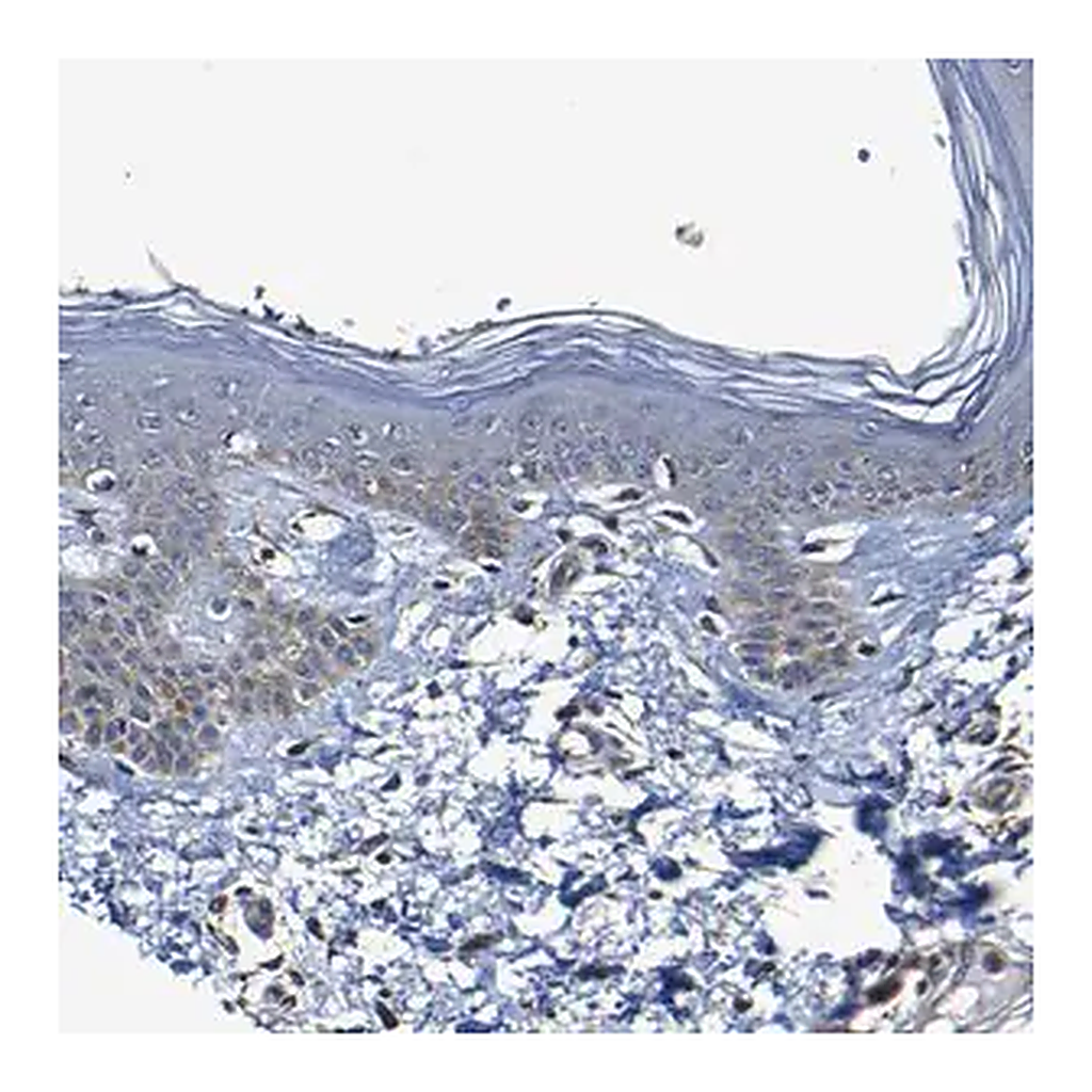 Merck Anti-ADAM15 antibody produced in rabbit