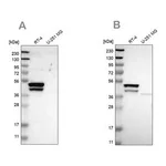Merck Anti-KRT23 antibody produced in rabbit