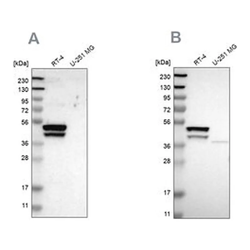 Merck Anti-KRT23 antibody produced in rabbit