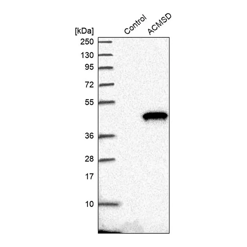 Merck Anti-ACMSD antibody produced in rabbit