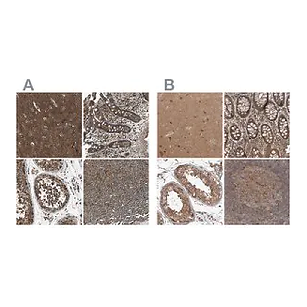 Merck Anti-ARHGEF11 antibody produced in rabbit