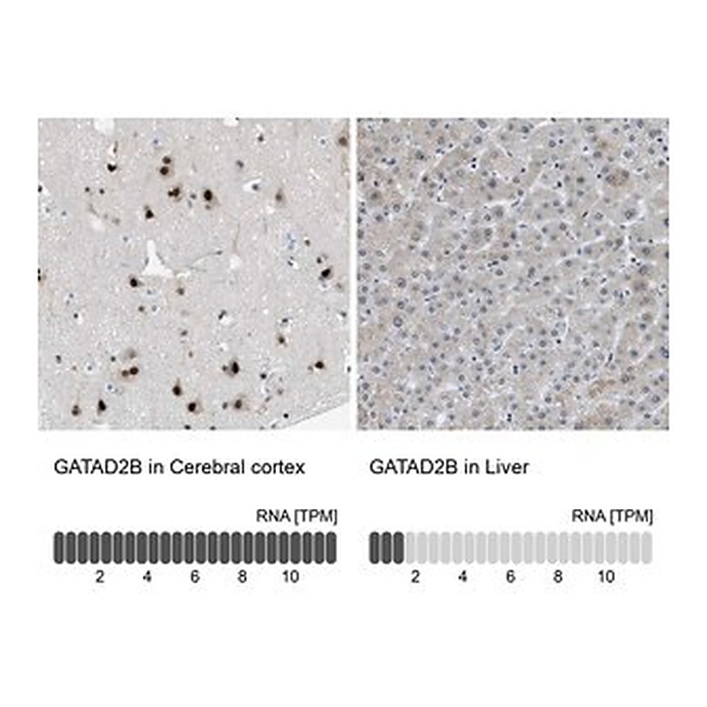 Merck Anti-GATAD2B antibody produced in rabbit