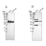 Merck Anti-CCDC51 antibody produced in rabbit