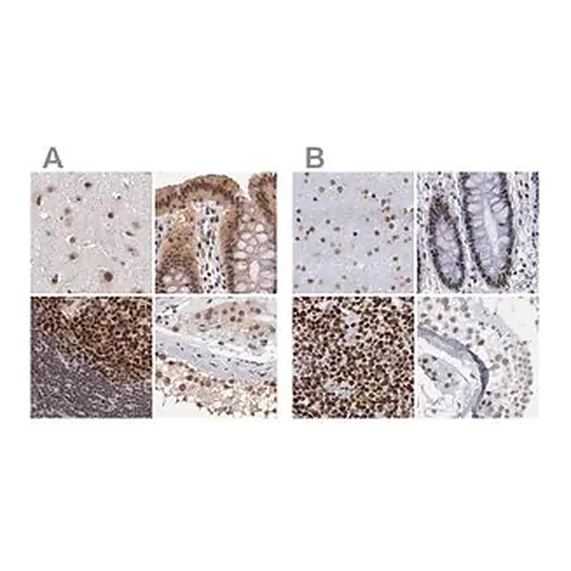 Merck Anti-TERF2 antibody produced in rabbit
