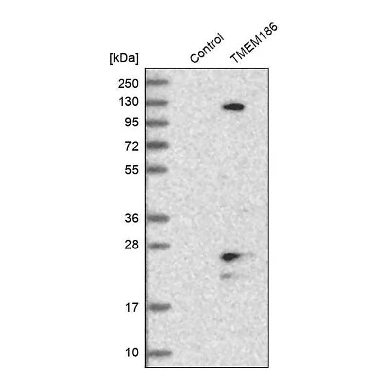 Merck Anti-TMEM186 antibody produced in rabbit