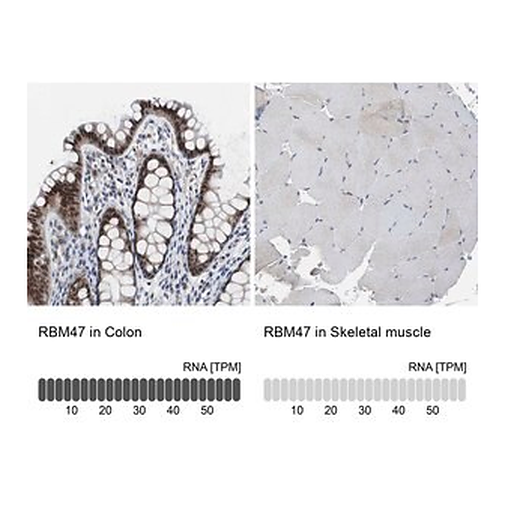 Merck Anti-RBM47 antibody produced in rabbit