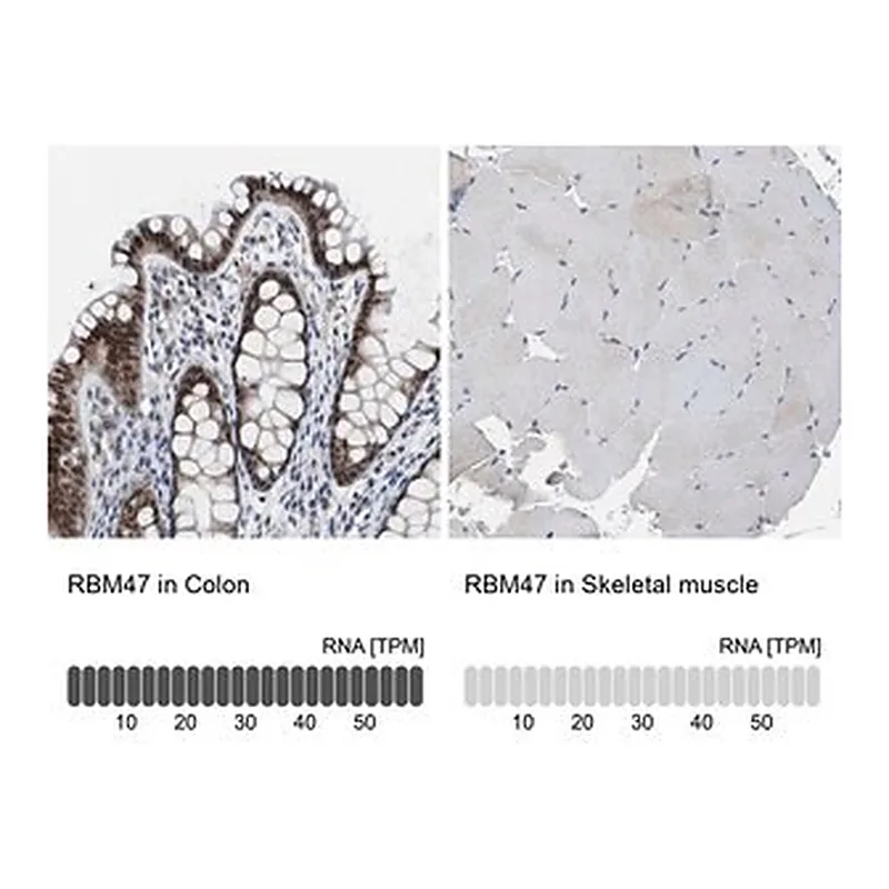 Merck Anti-RBM47 antibody produced in rabbit