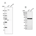 Merck Anti-SMARCB1 antibody produced in rabbit