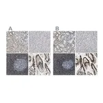 Merck Anti-SP100 antibody produced in rabbit