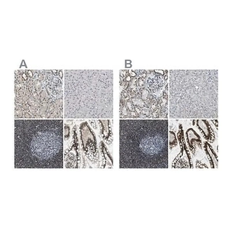 Merck Anti-SP100 antibody produced in rabbit