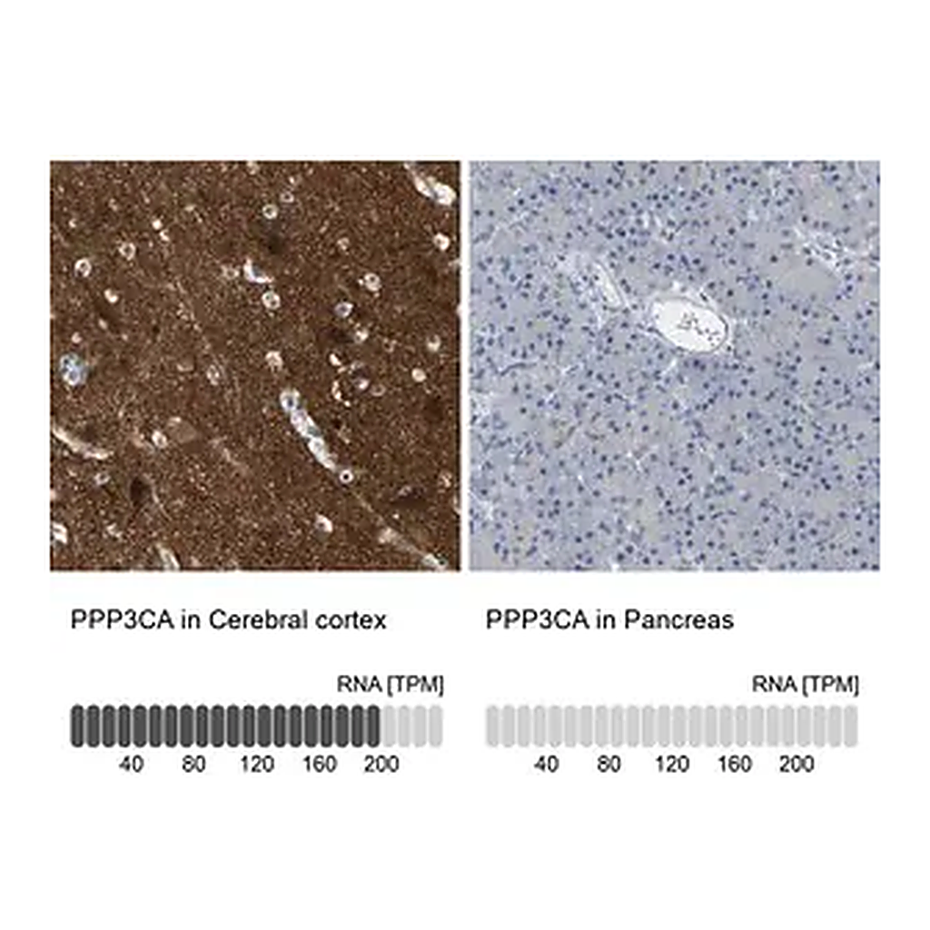 Merck Anti-PPP3CA antibody produced in rabbit