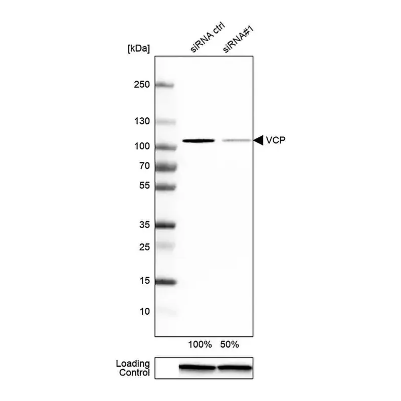 Merck Anti-VCP antibody produced in rabbit