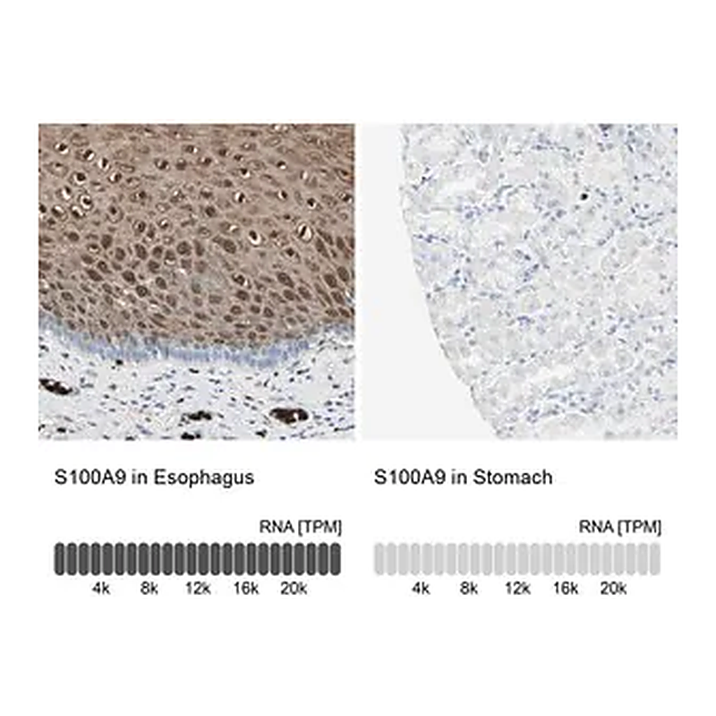 Merck Anti-S100A9 antibody produced in rabbit