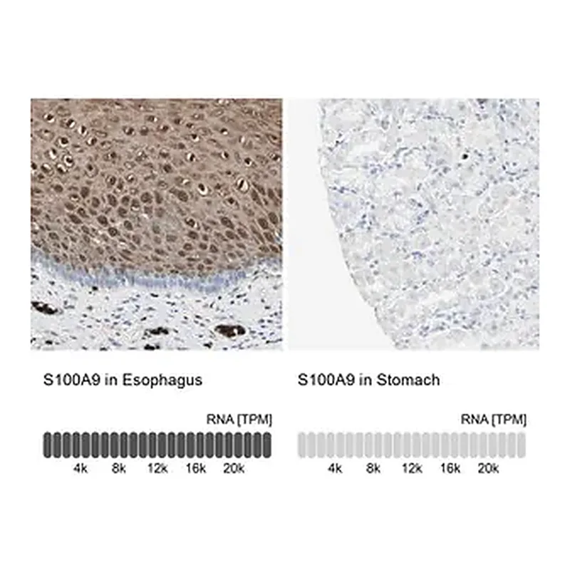 Merck Anti-S100A9 antibody produced in rabbit