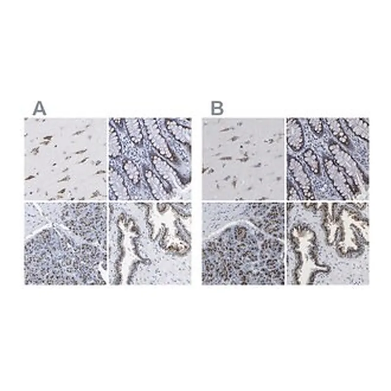 Merck Anti-TMEM87A antibody produced in rabbit