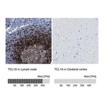 Merck Anti-TCL1A antibody produced in rabbit