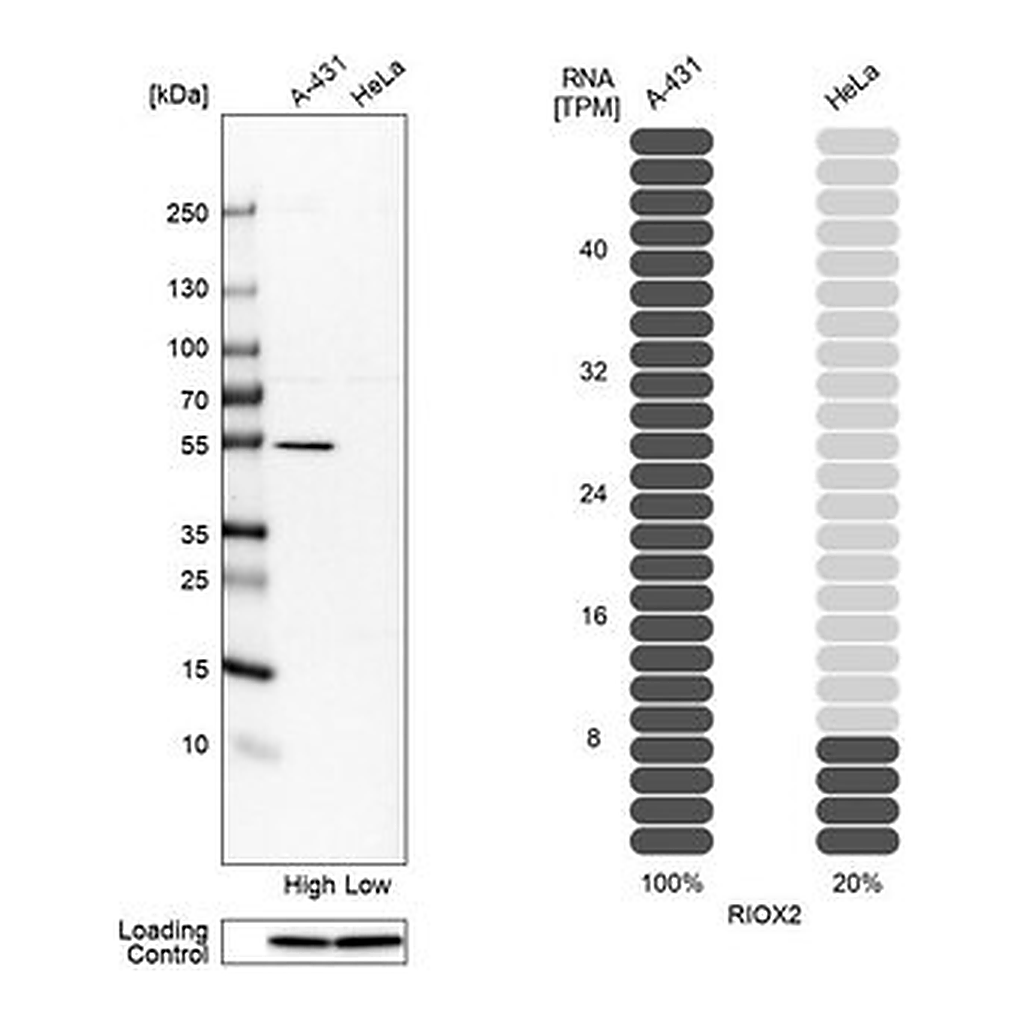 Merck Anti-RIOX2 antibody produced in rabbit