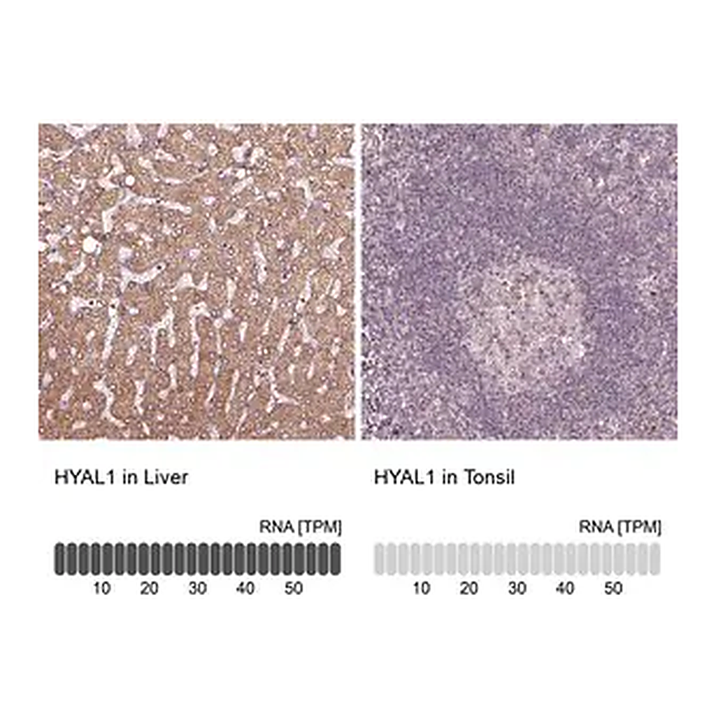 Merck Anti-HYAL1 antibody produced in rabbit
