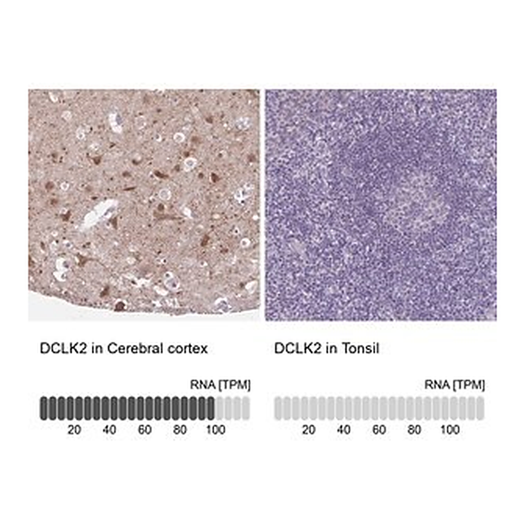 Merck Anti-DCLK2 antibody produced in rabbit