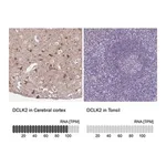 Merck Anti-DCLK2 antibody produced in rabbit