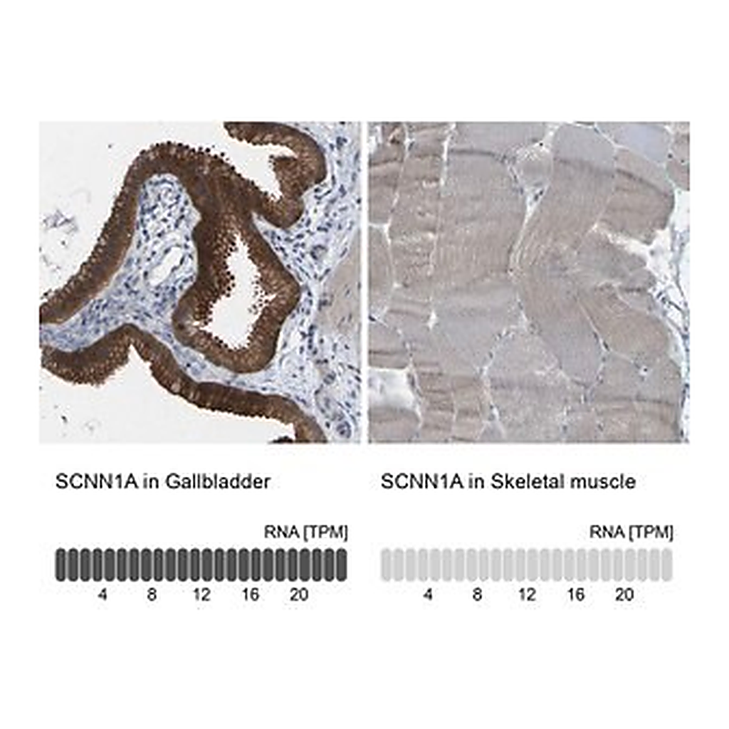 Merck Anti-SCNN1A antibody produced in rabbit