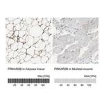 Merck Anti-PRKAR2B antibody produced in rabbit