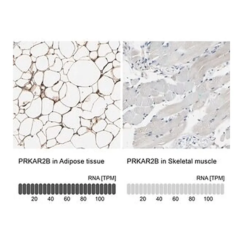 Merck Anti-PRKAR2B antibody produced in rabbit